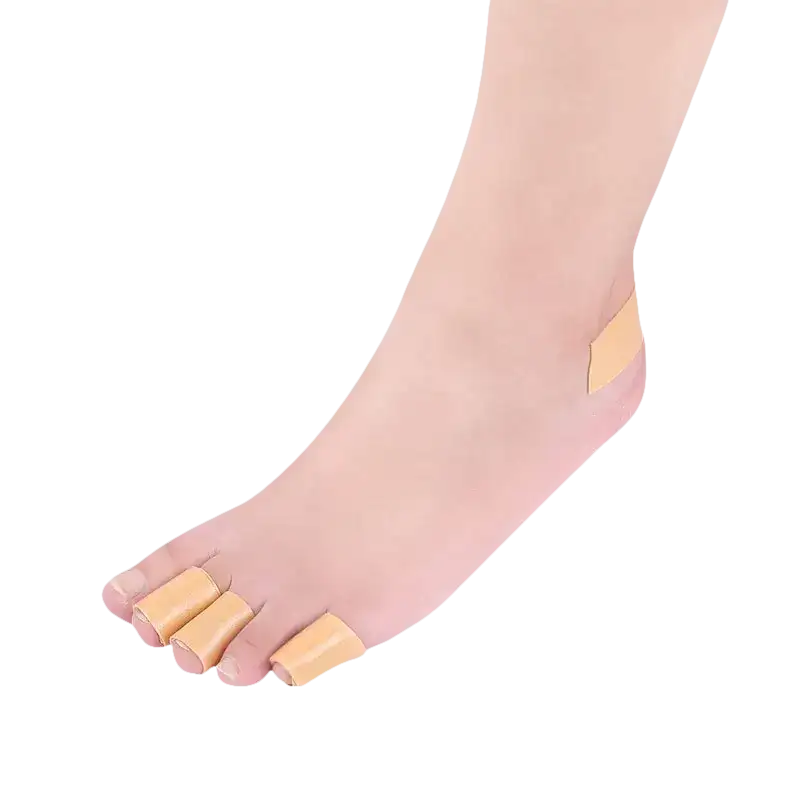 Foot with toe bandages.