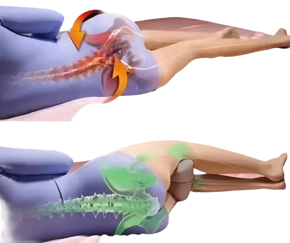 Spine alignment comparison with knee pillow.