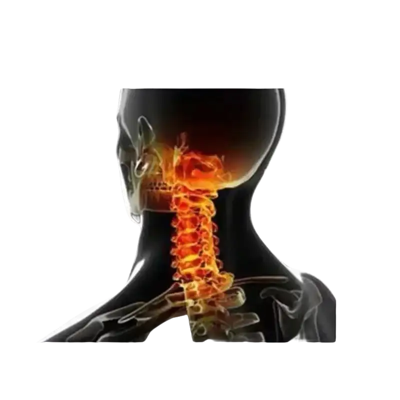 Anatomical illustration of neck and shoulder pain.