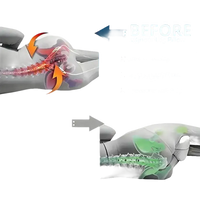 Leg pillow comparison for Knee Up for a Laugh ergoleg relief pillow and leg support pillow