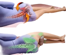 Spine alignment comparison with knee pillow.