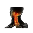 Anatomical illustration of neck and shoulder pain.