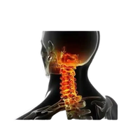 Anatomical illustration of neck and shoulder pain.